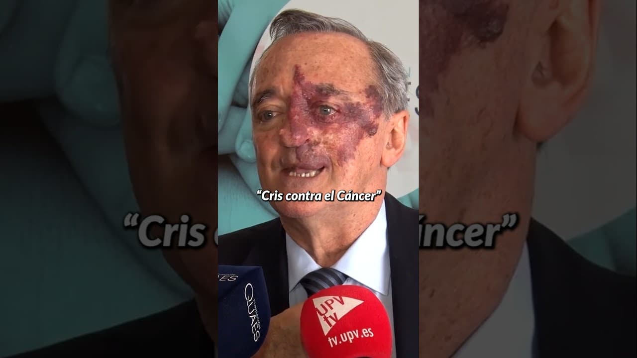 CURAN EL PEOR CANCER!!! Pero hay otro...
